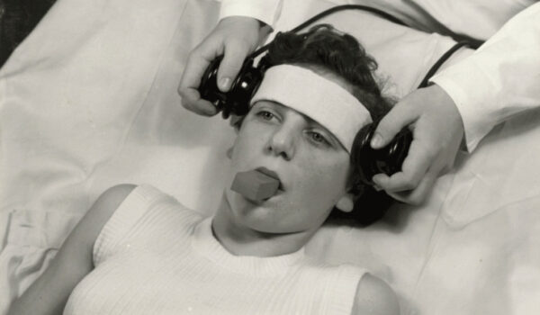 10 bizarnih medicinskih tretmana iz prošlosti